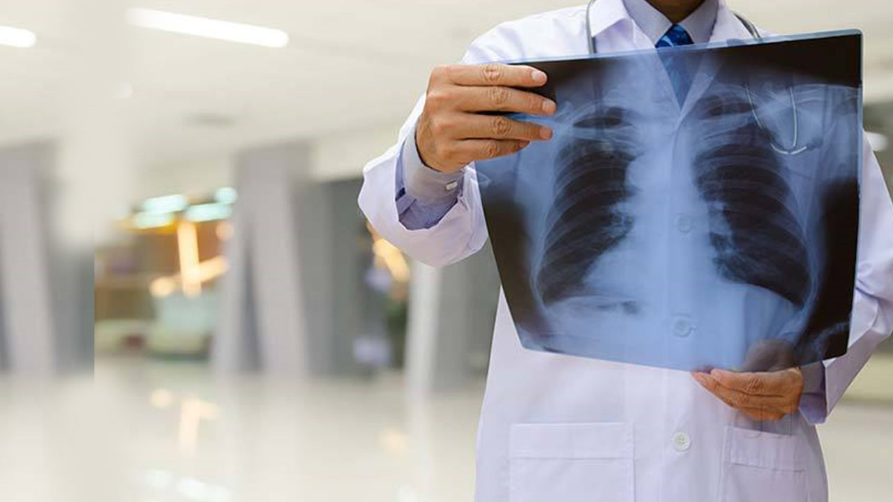 Tuberculosis is deadly but could be prevented