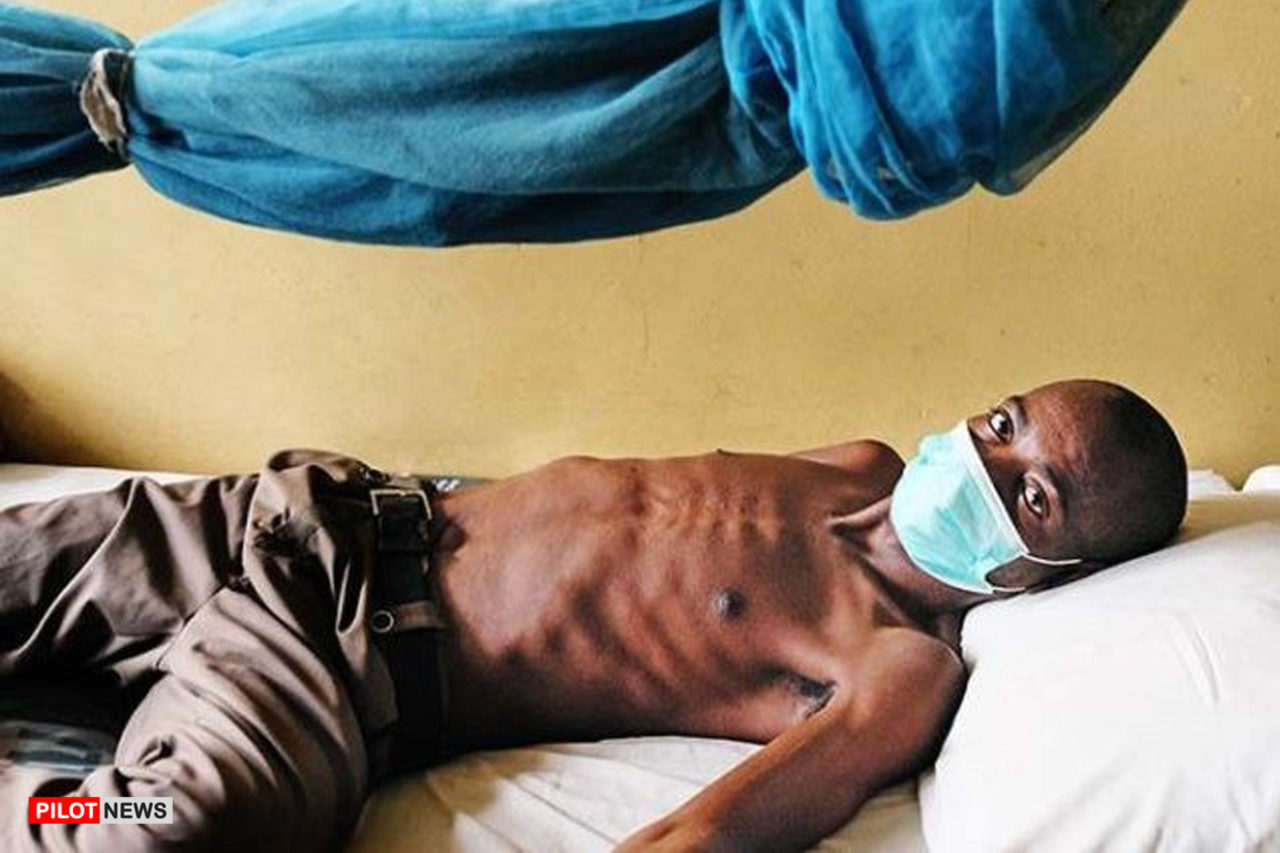 https://www.westafricanpilotnews.com/wp-content/uploads/2020/02/Tuberculosis-patient-1280x853.jpg