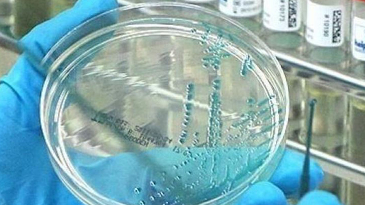 Swiss researchers Plan to Roll Out New Coronavirus Vaccine in October