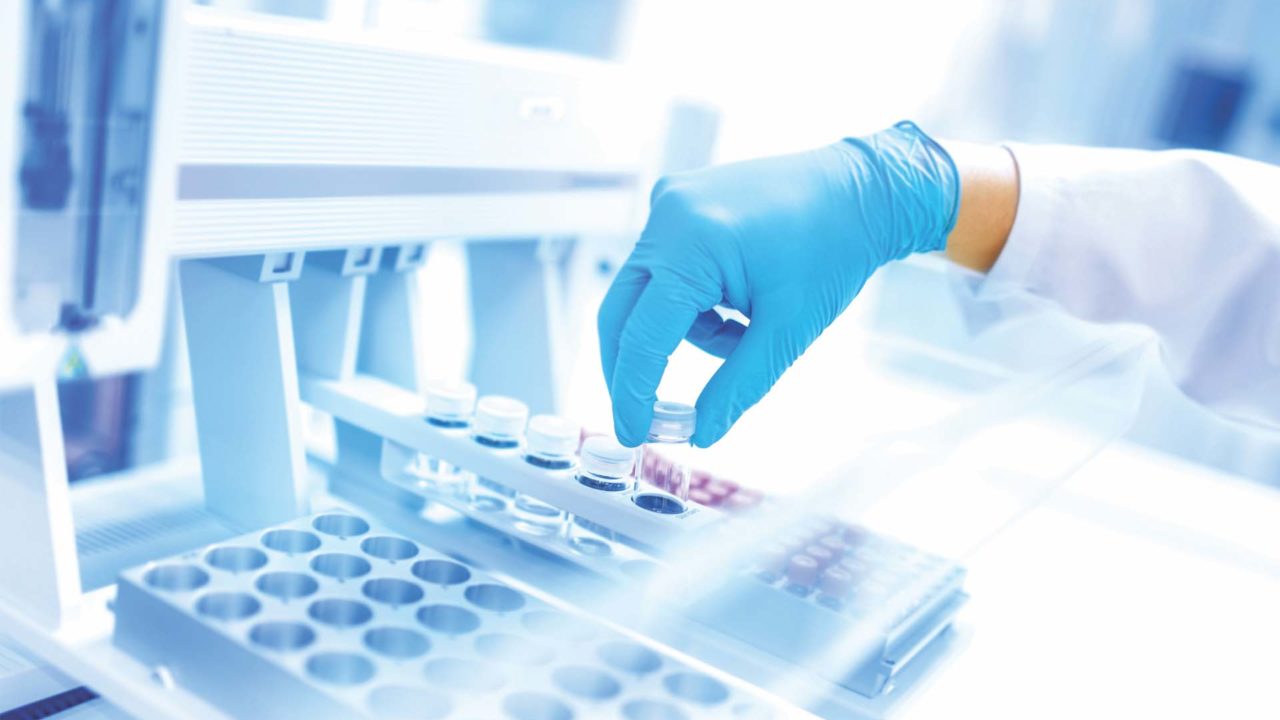 One COVID-19 Test Costs $20 – NCDC Reacts to Senegal Cheaper Testing Method