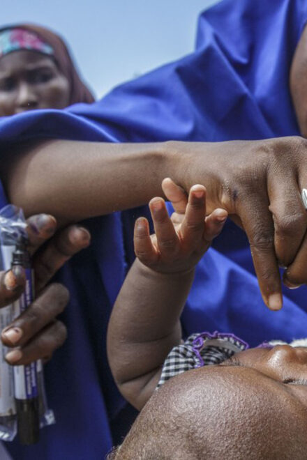 New Polio Virus In Some States-NPHCDA