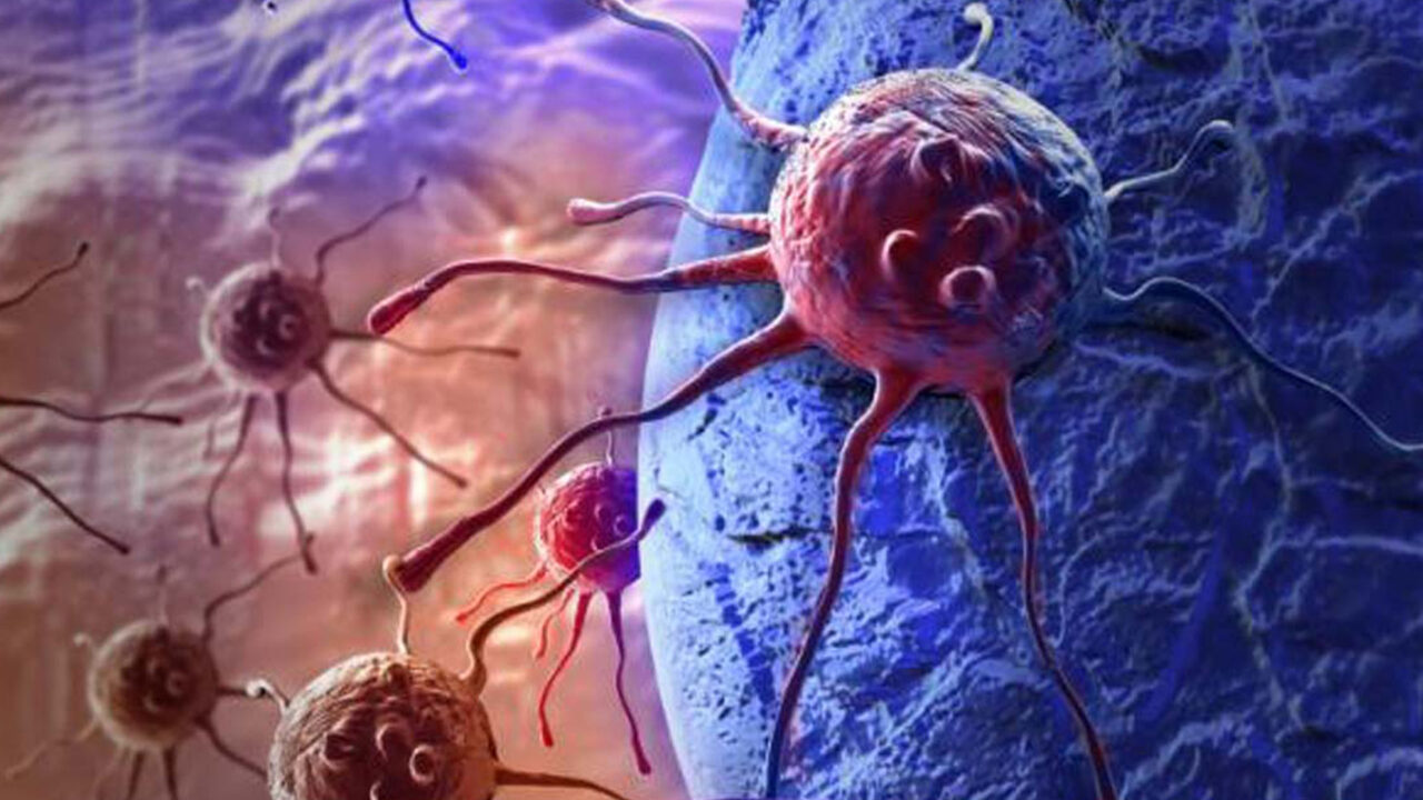 https://www.westafricanpilotnews.com/wp-content/uploads/2020/12/Cancer-Cell_12-28-20-1280x720.jpg