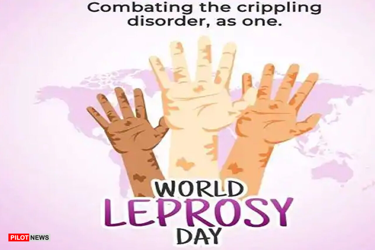 https://www.westafricanpilotnews.com/wp-content/uploads/2021/02/Leprosy-World-Leprosy-Day-2021-2-1-21-1280x853.jpg