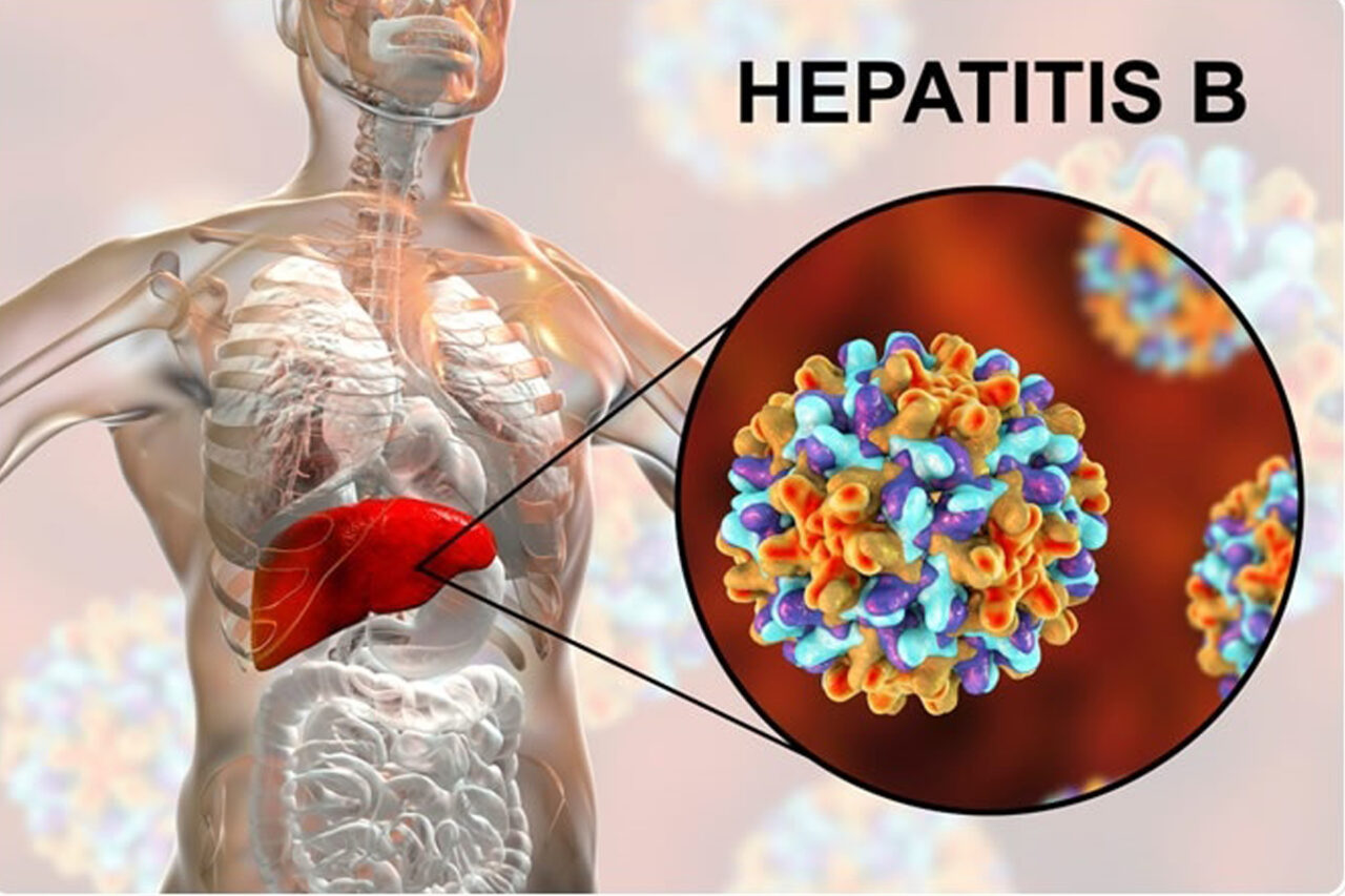 https://www.westafricanpilotnews.com/wp-content/uploads/2021/04/Hepatitis-B-Virus-image-4-12-1280x853.jpg