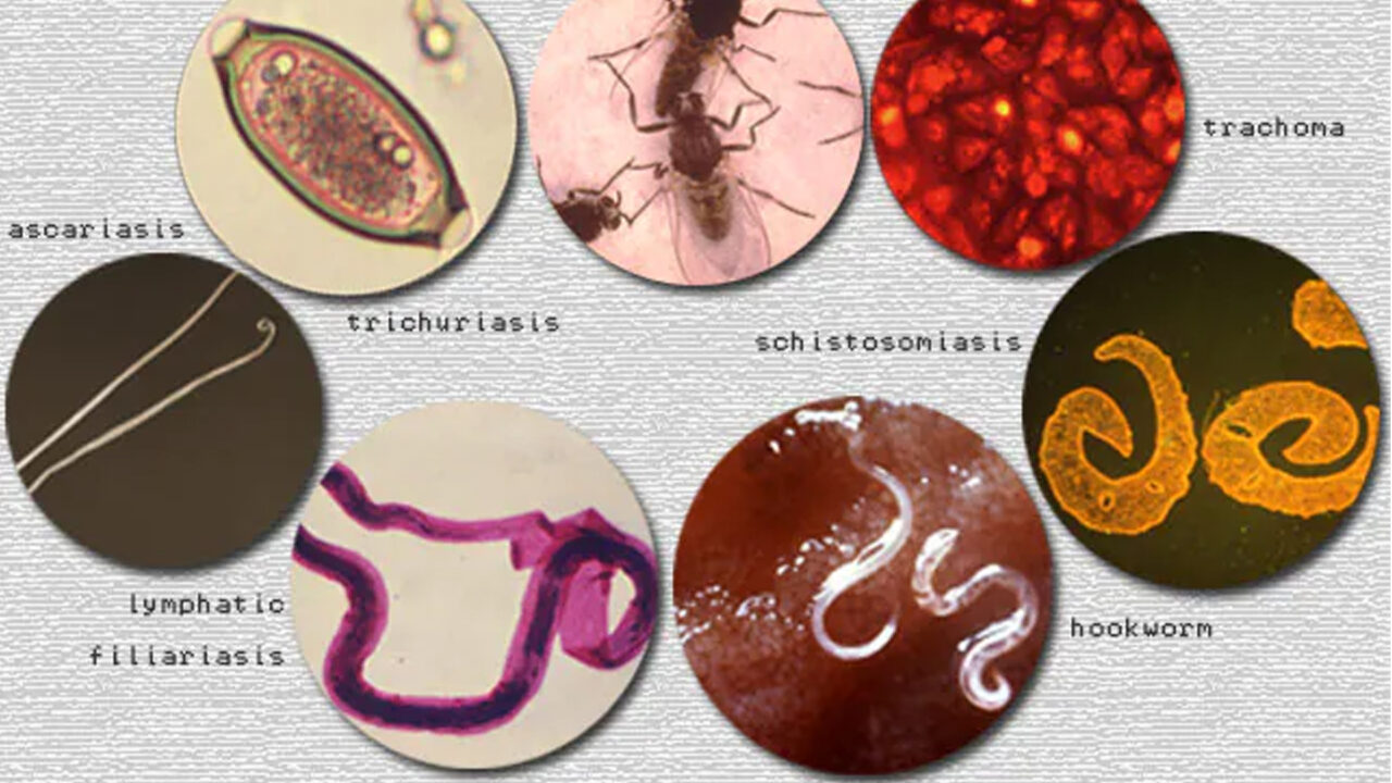 Bauchi Treated 987,635 Persons For Neglected Tropical Diseases