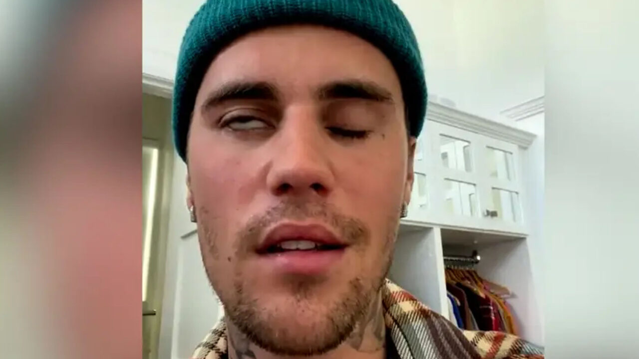 Justin Bieber Struck By Facial Paralysis, Cancels Shows
