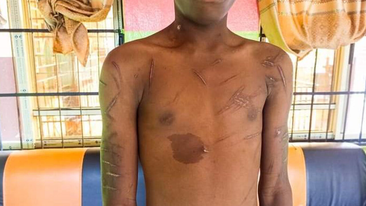 Anambra Commissioner Rescues 17-year-old Boy From Abusive Guardians