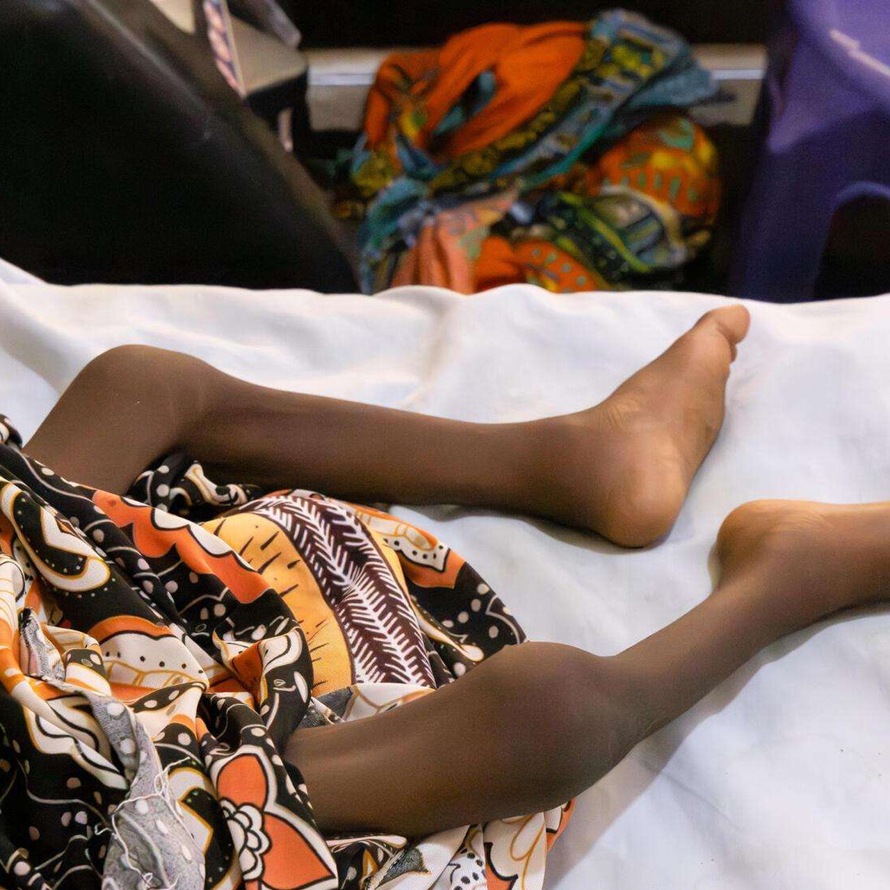 6.4 Million Children In Northern Nigeria Faces Malnutrition 