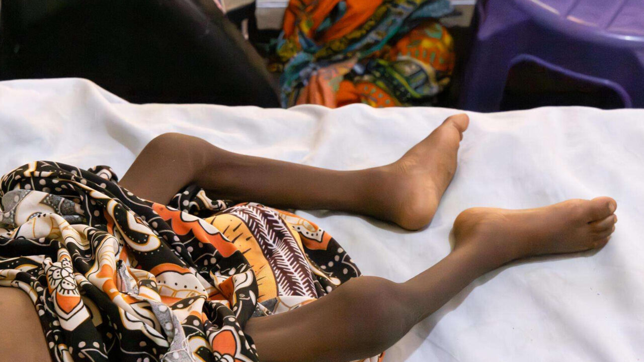 Northeast and Northwest Have Over 4m Malnourished Children
