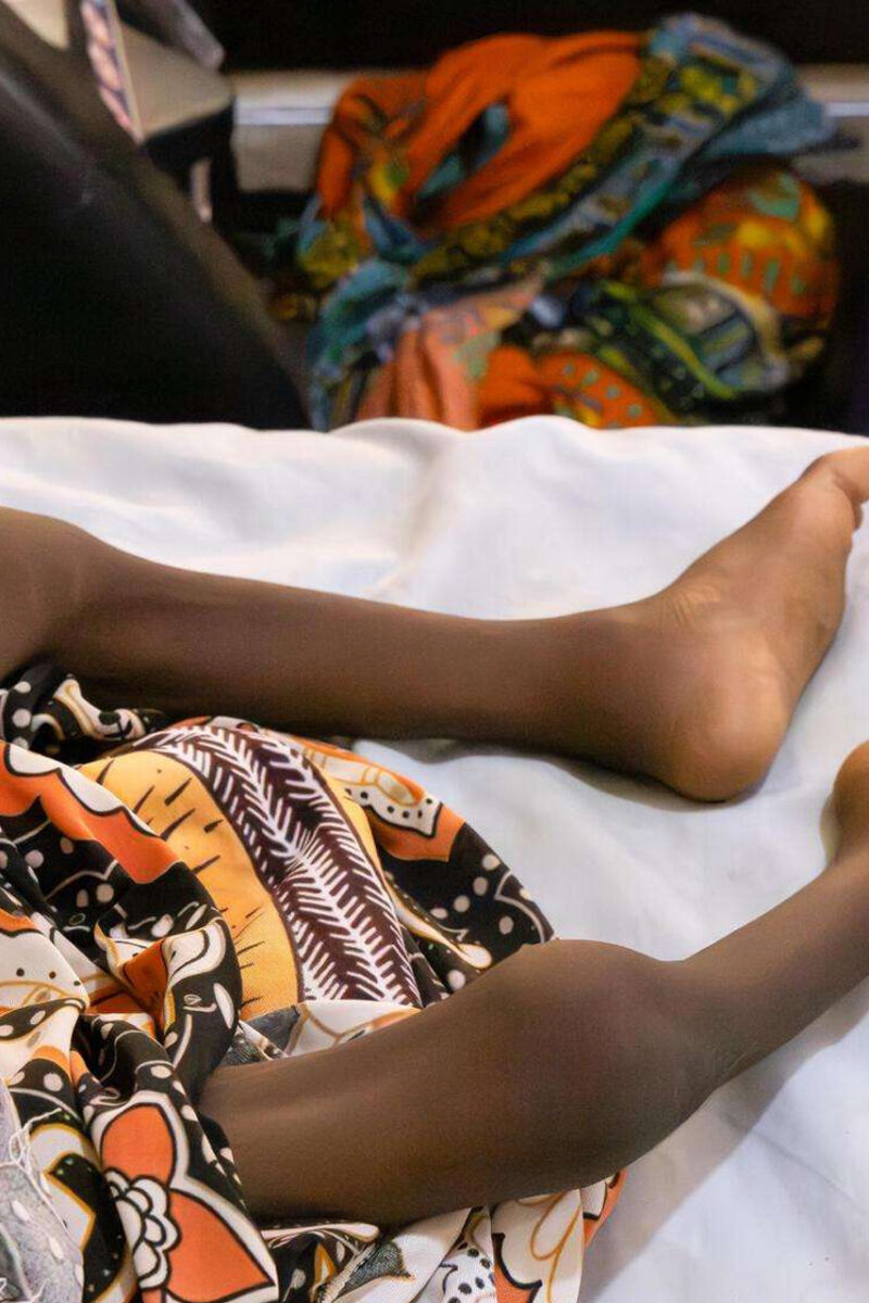 6.4 Million Children In Northern Nigeria Faces Malnutrition 