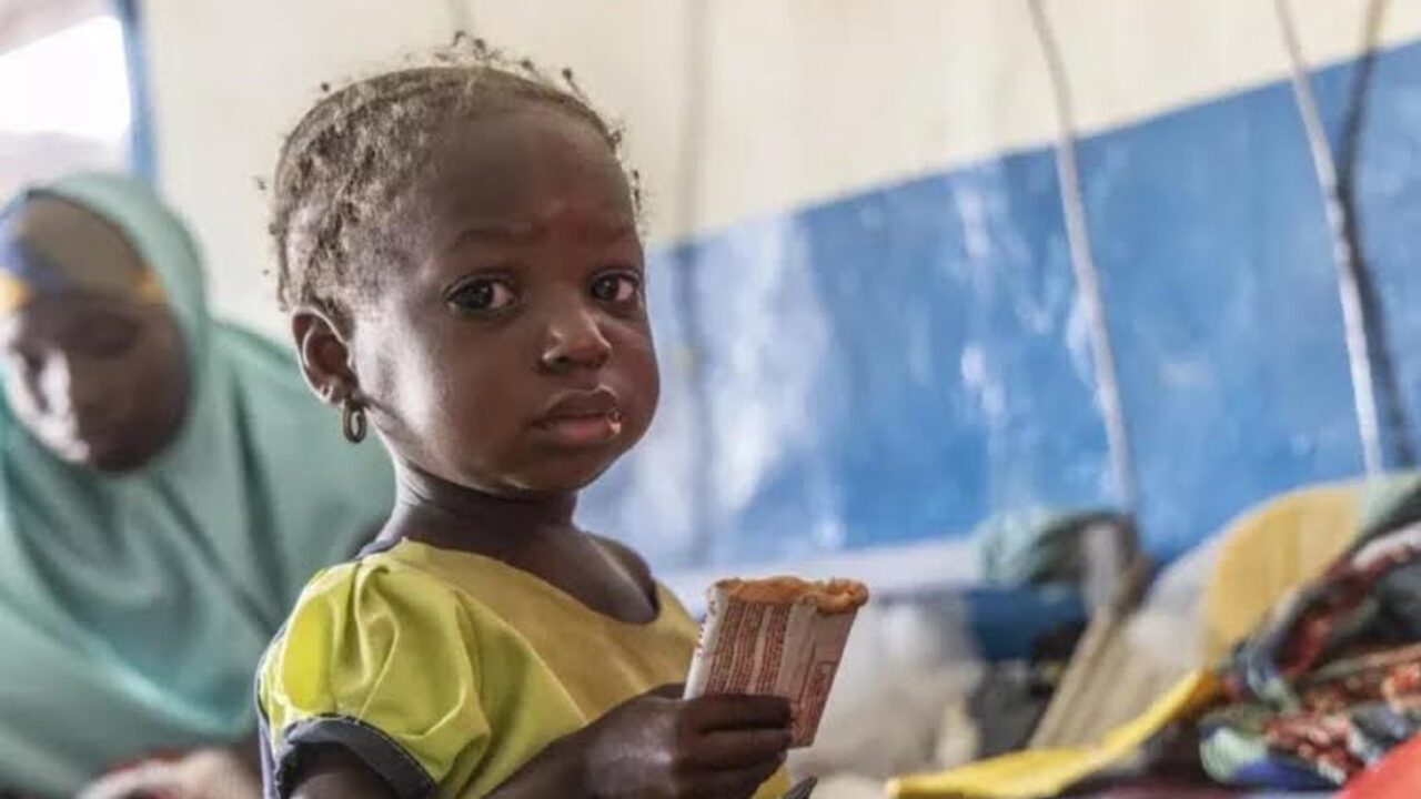 Over 2.8M Northern Children, Pregnant Women Needs Nutritional Intervention