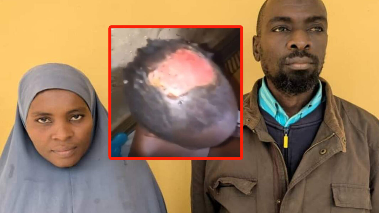 Brutality: Police Arrest Woman, Accomplice For Abuse Of Stepdaughter